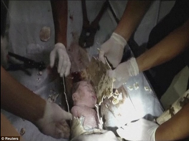 Videó! Élve megmenekült az újszülött, akit lehúztak szülei a WC-n