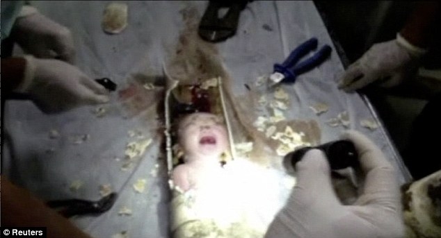 Csecsemőt mentettek ki a WC alatti szennyvízcsőből élve!
