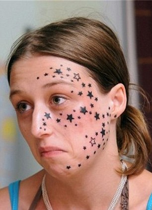 Három évig tartott amíg leszedette arcáról az 56 darab csillag tetoválást