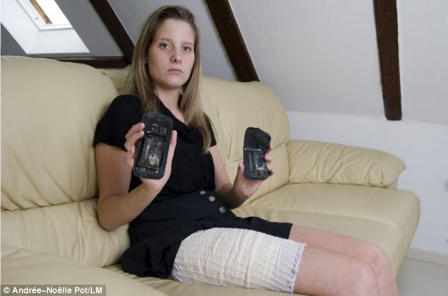 A felrobbant okostelefon másodfokú égési sérüléseket okozott a fiatal lánynak