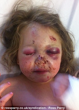 Motorosok gázoltak el egy három éves kislányt