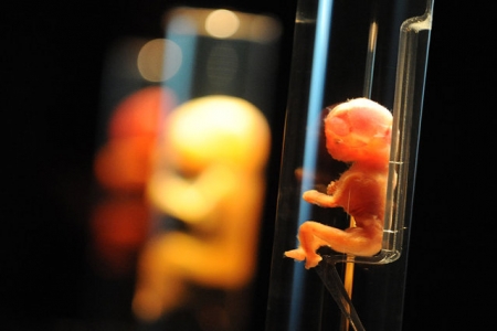 Emberi embrióval ránctalanítunk?