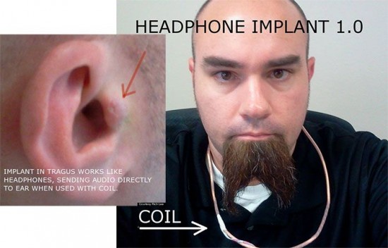 headphone-implant-550x352