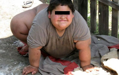 Az öt éves 120 kilogrammos kisfiút az udvaron tartják 