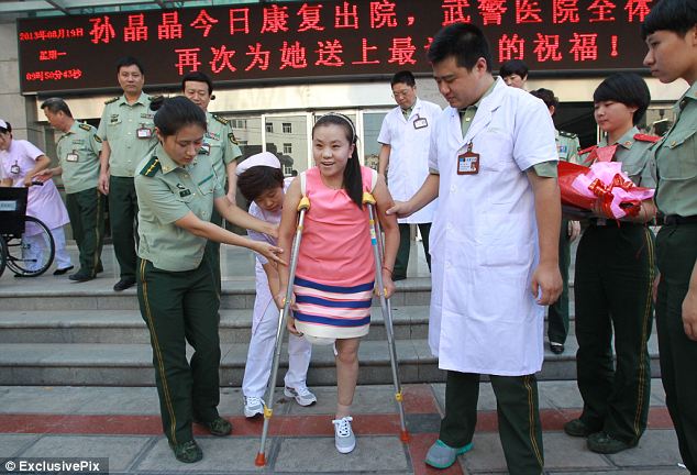 A kínai lány boldog, hogy végre amputálták deformálódott lábát