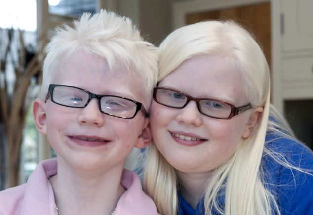 Az albínó gyerekek édesanyjuk szerint sztárok lesznek 