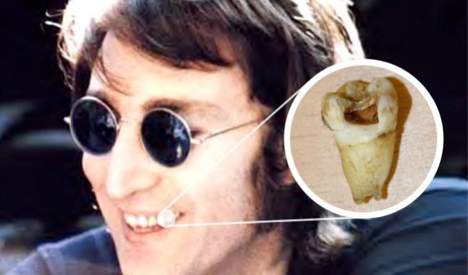 Klónoznák John Lennont - a zápfogából
