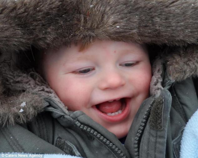 Furcsa genetikai rendellenessége miatt folyamatosan mosolyog a kisfiú