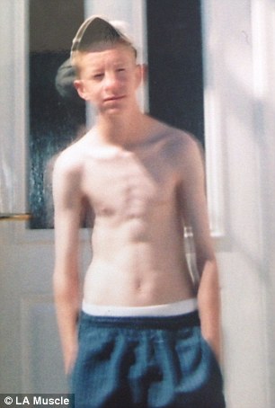 Az anorexiás fiú legyőzte félelmeit és testépítő lett 