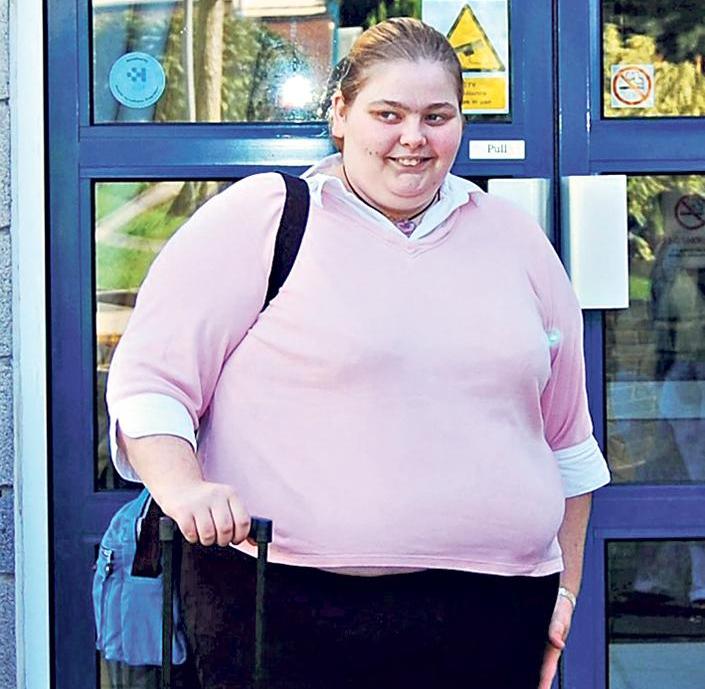 Nagyon kövér volt a lány, majd gyomorszűkítés után életveszélyesen anorexiás lett - 170 kg-ot fogyott!