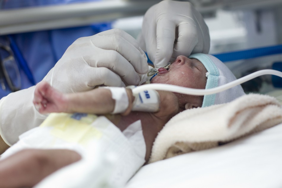 Öt hetes csecsemő veséje mentett életet
