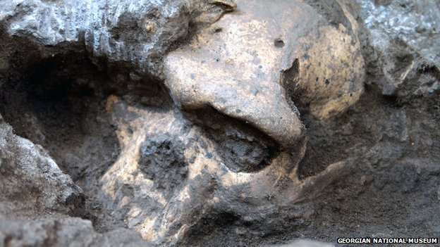 A grúz előember a Homo erectus fajához tartozott egy új kutatás szerint