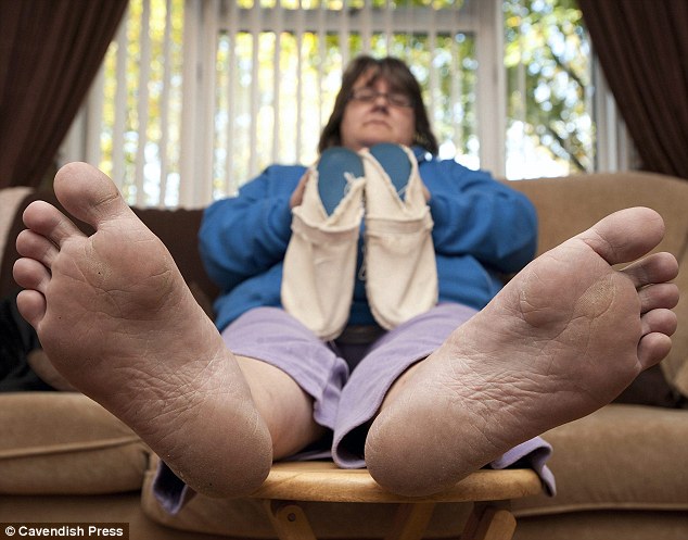 A nő 20 éve nem dolgozik mert allergiás a cipőkre! - most megvonták a támogatását