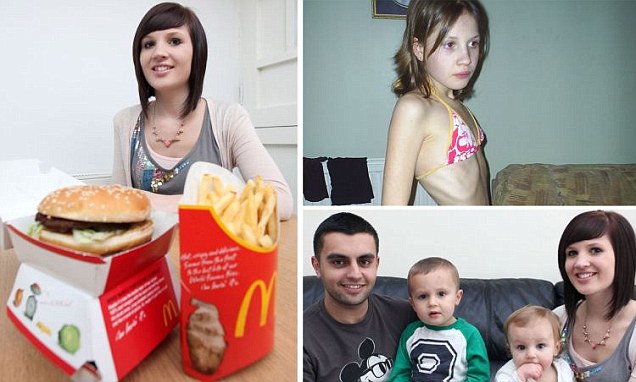 Közel halálos anorexiáját győzte le azzal, hogy a McDonald’s-ban vállalt munkát - fotó