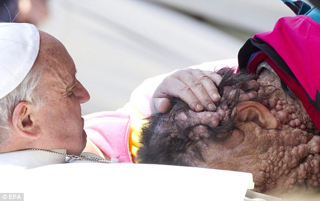 Megható pillanat: Ferenc pápa arcon csókolta a súlyosan beteg férfit