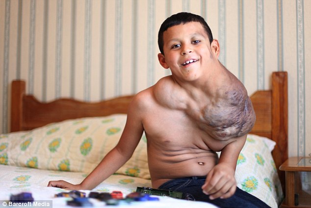 A tízéves fiú hatalmas tumorját Viagrával gyógyítják