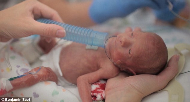 Szívszorító videó egy koraszülött baba első évéről