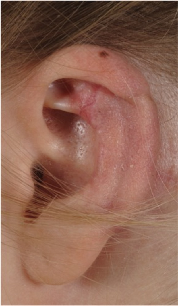 ear-4-reconstructed