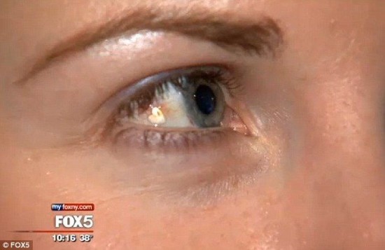 eye-implant2-550x357