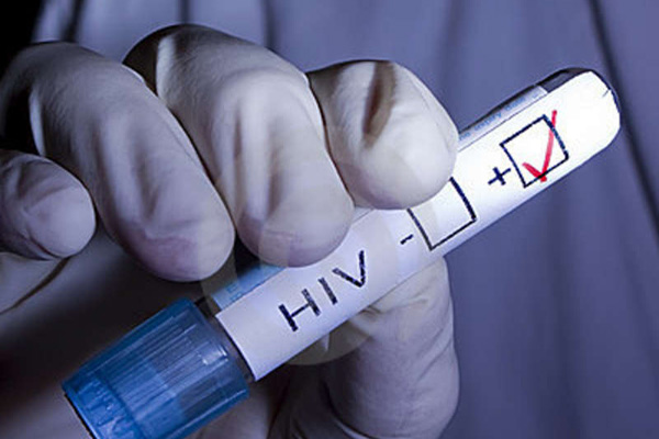A kórház többeket is HIV-fertőzöttként diagnosztizált - tévesen