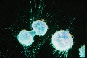 ovarian-cancer-cells