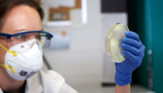 bacteria-lab-test