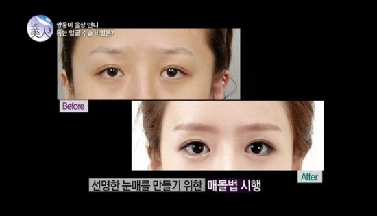 cosmetic-surgery4-550x315