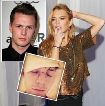 Lindsay Lohan megverette Paris Hilton öccsét