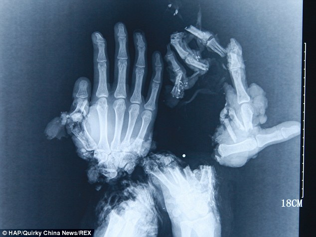 article-2535155-1A77B96B00000578-26_634x476