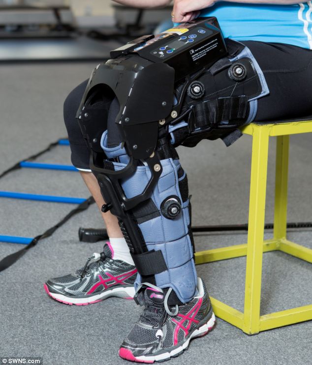 A stroke túlélő nő újra tanul járni egy bionikus láb segítségével, ami 