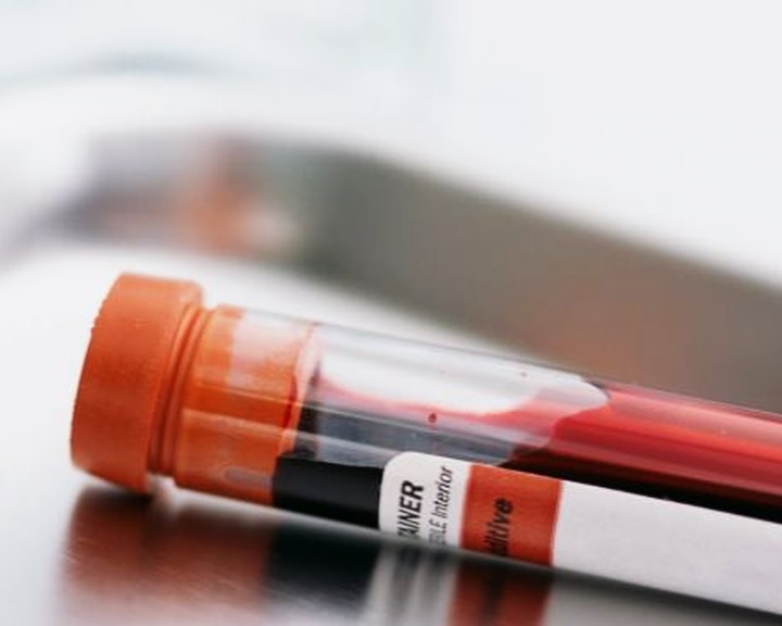 Hőtérképes vérvizsgálattal kimutatható a méhnyakrák egy kutatás szerint