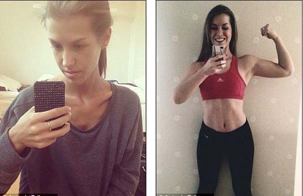 Anorexiásból fittness guruvá vált egy svéd lány! - képek és videó