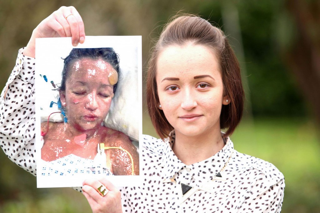 £££Leanne-Howes-Skin-disease-3165607