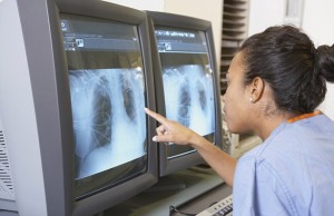 Doctor studying chest x-rays on monitors