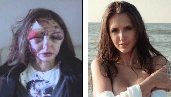 Úgy megverte barátnőjét az orosz milliomos, hogy leginkább ez zombira hasonlít a lány