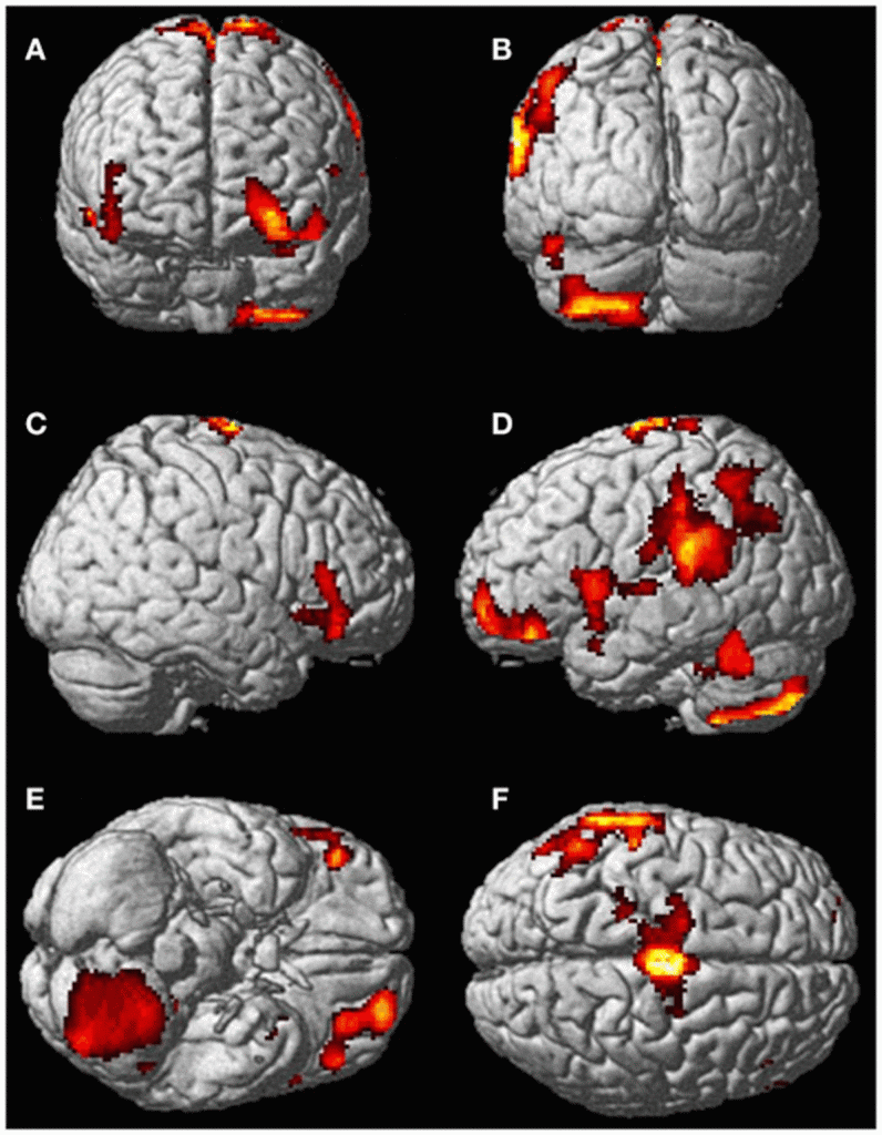 Scientists_Scanned_A_Woman's_Brain-d406f50b2948df9924612bfe89332a54