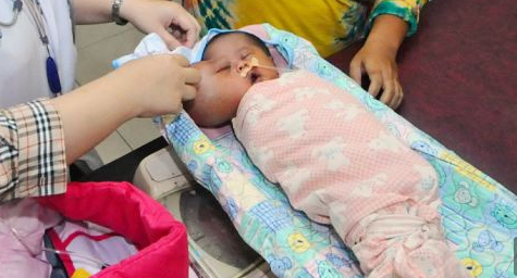 Szív alakú fejjel született az indonéz kisfiú 