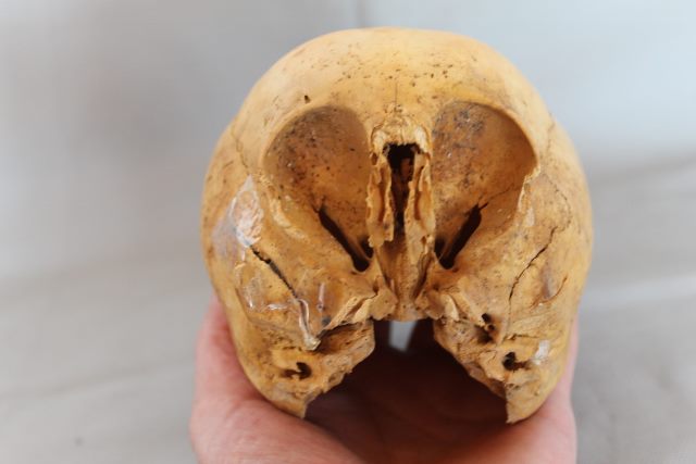 Új fajé lehet a Peruban talált csillaggyermek koponya?