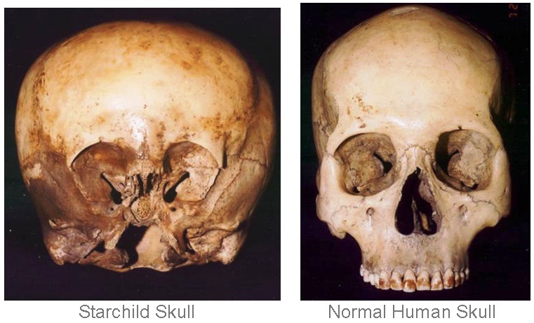 starchild-skull