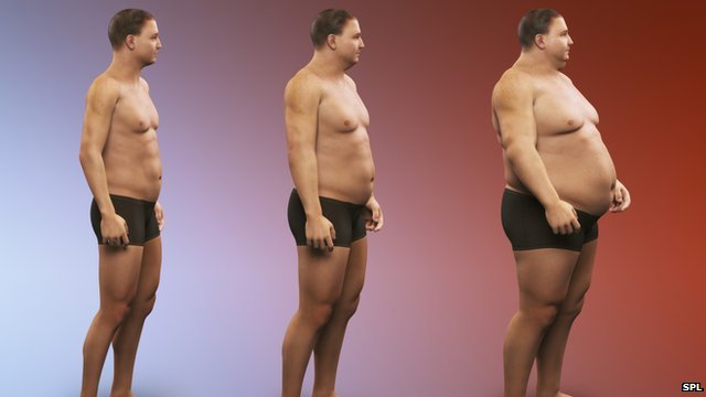 Tízféle rosszindulatú daganatféleség kockázatát növeli a túlsúly és az elhízás