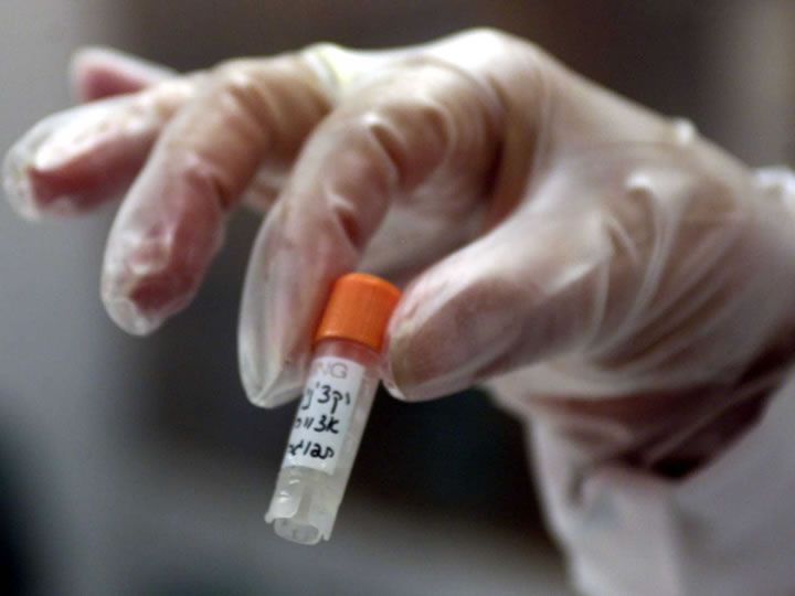 Ebola - Meghalt a kísérleti gyógyszerrel kezelt libériai beteg