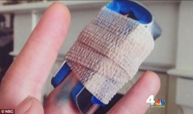 Majdnem kétmillió forintos számlát kapott egy férfi, miután kezelték elvágott ujját