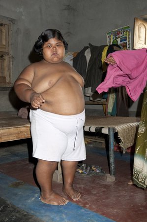 896866_indie-obezita-obezni-suman-khatun-dite