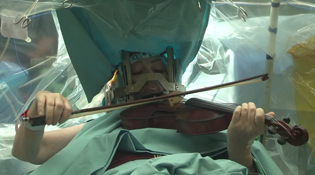 Agyműtétje közben Mozartot játszott hegedűn - videó