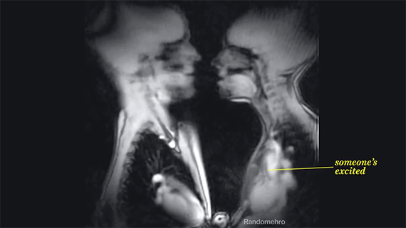 Hogyan nézhet ki a teste belülről amikor csókolózik? Nézze meg! - videó 