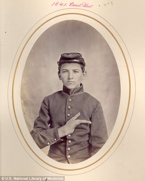 Portrék az Amerikai polgárháborúban sérült katonákról 