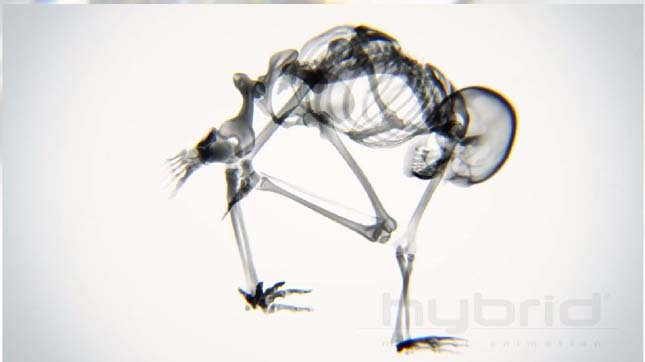 Így mozognak csontjaink a röntgenfelvétel alatt – videó