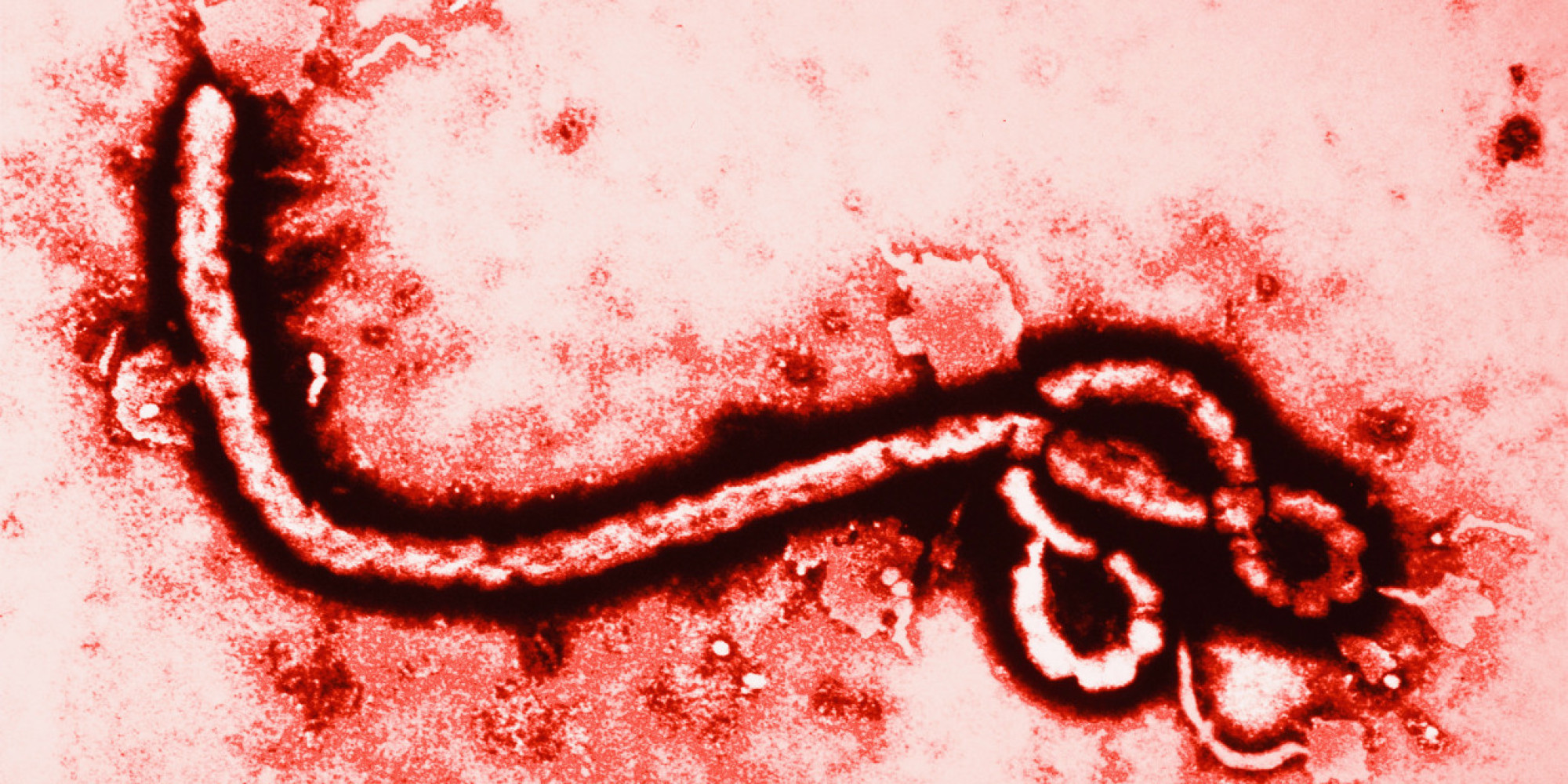 Ebola - Megkezdték az ellenőrzéseket a csehországi repülőtereken