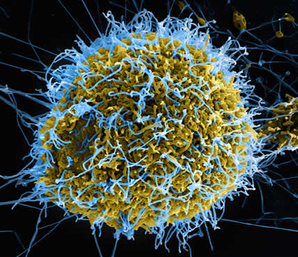 ebola vakcina