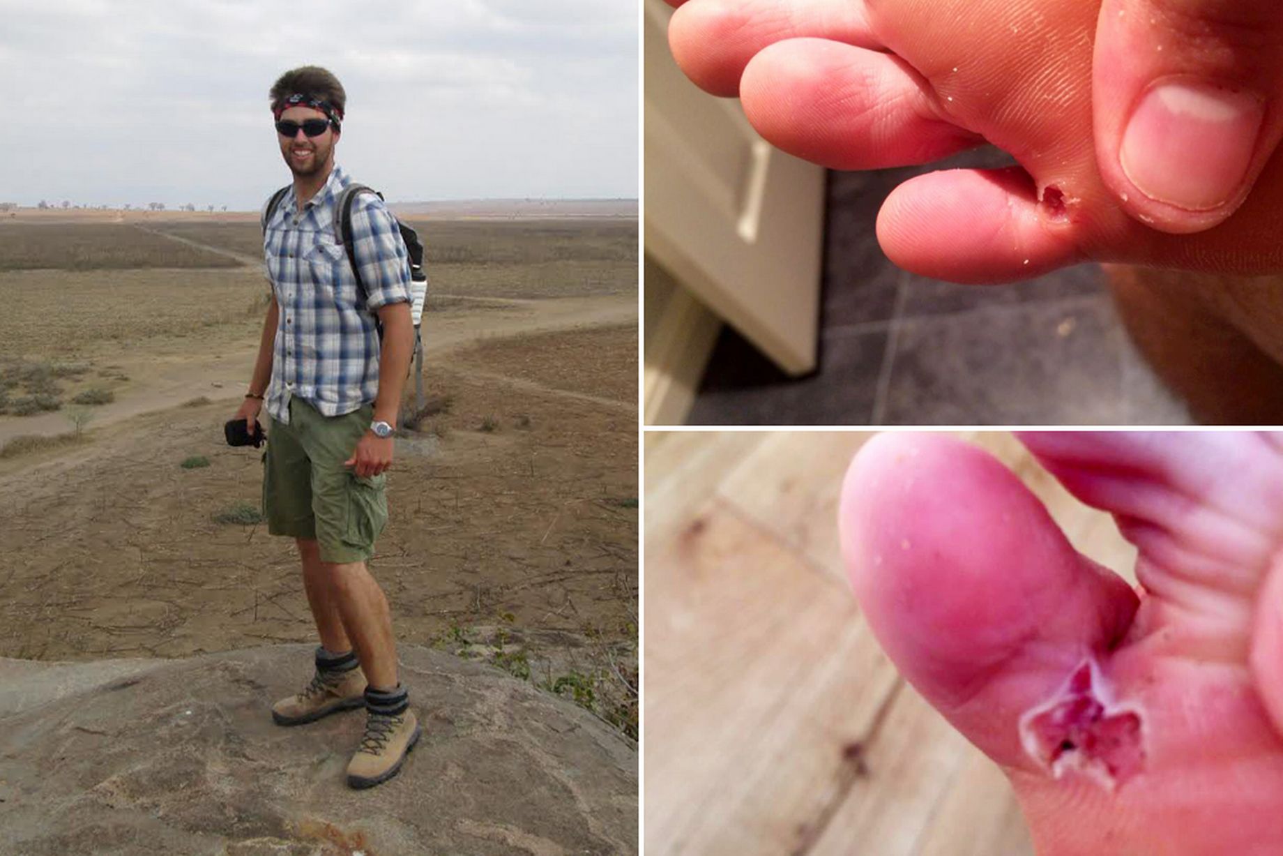 Hazatért Afrikából egy brit önkéntes, egy hónap múlva kiderült: potyautast is hozott magával – +18 fotók és videó